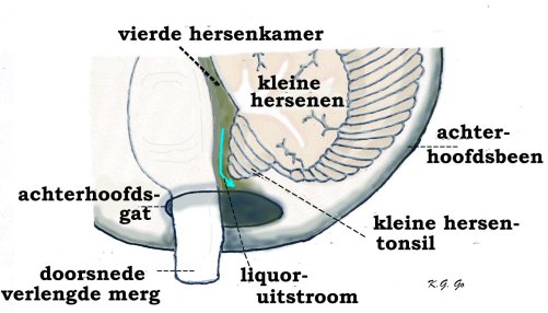 normaal